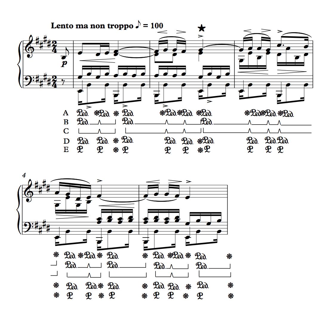 Chopin Etude.jpg