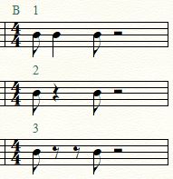 Notes vs. rests 2.JPG